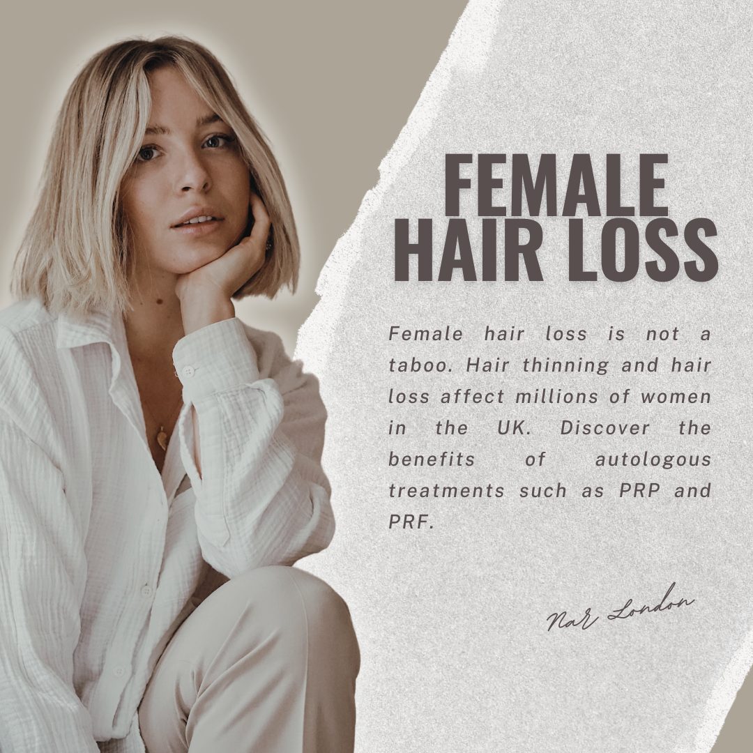 Female hair loss PRF