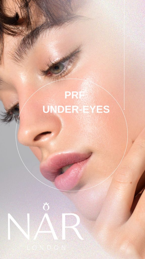 PRF Under-eye treatment
