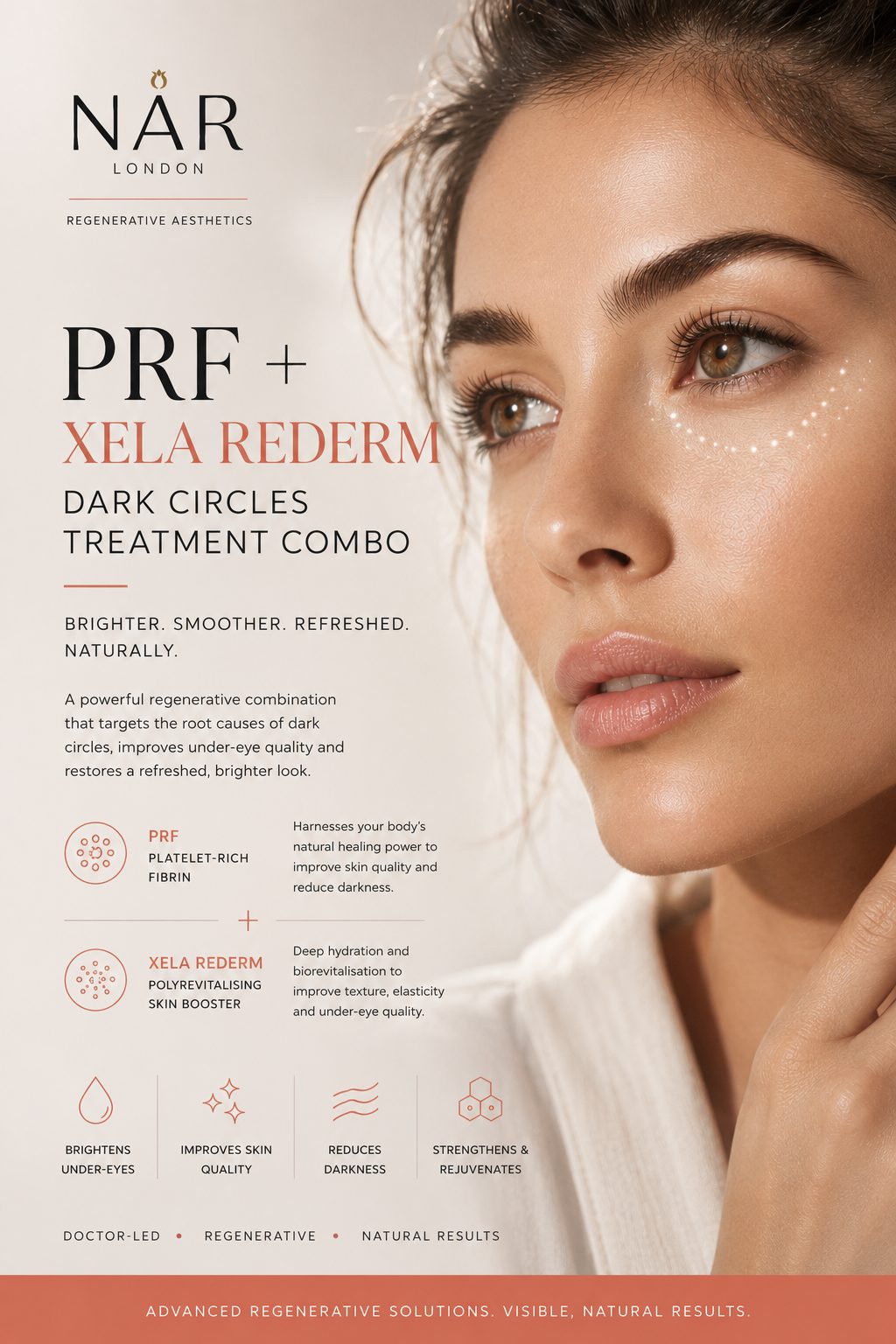Dark-Circles-Treatment-London Dark Circles London