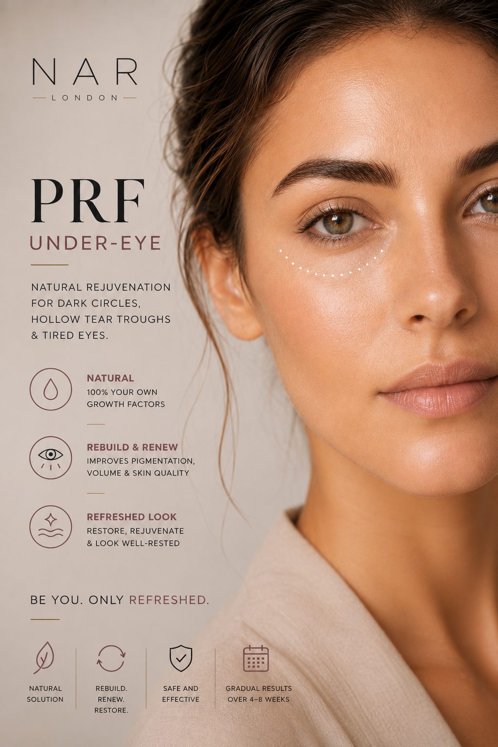 PRF-Under-Eyes_London-UK PRF UNDER-EYES LONDON