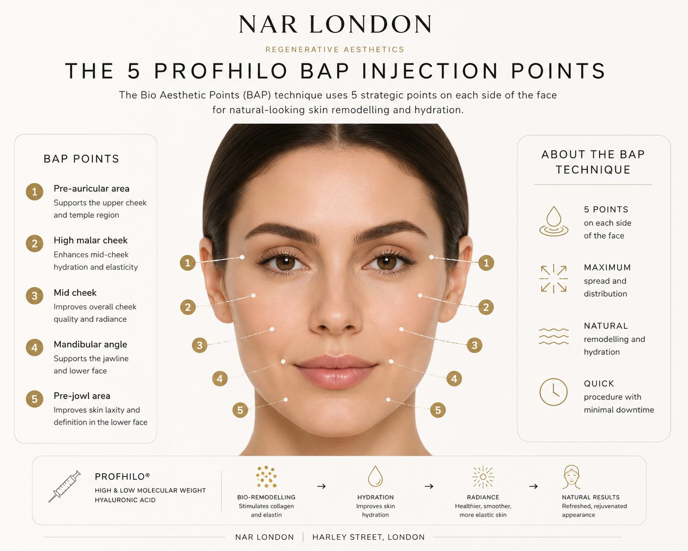 Profhilo-BAP-Injection-Points-NAR_LONDON Profhilo BAP injection