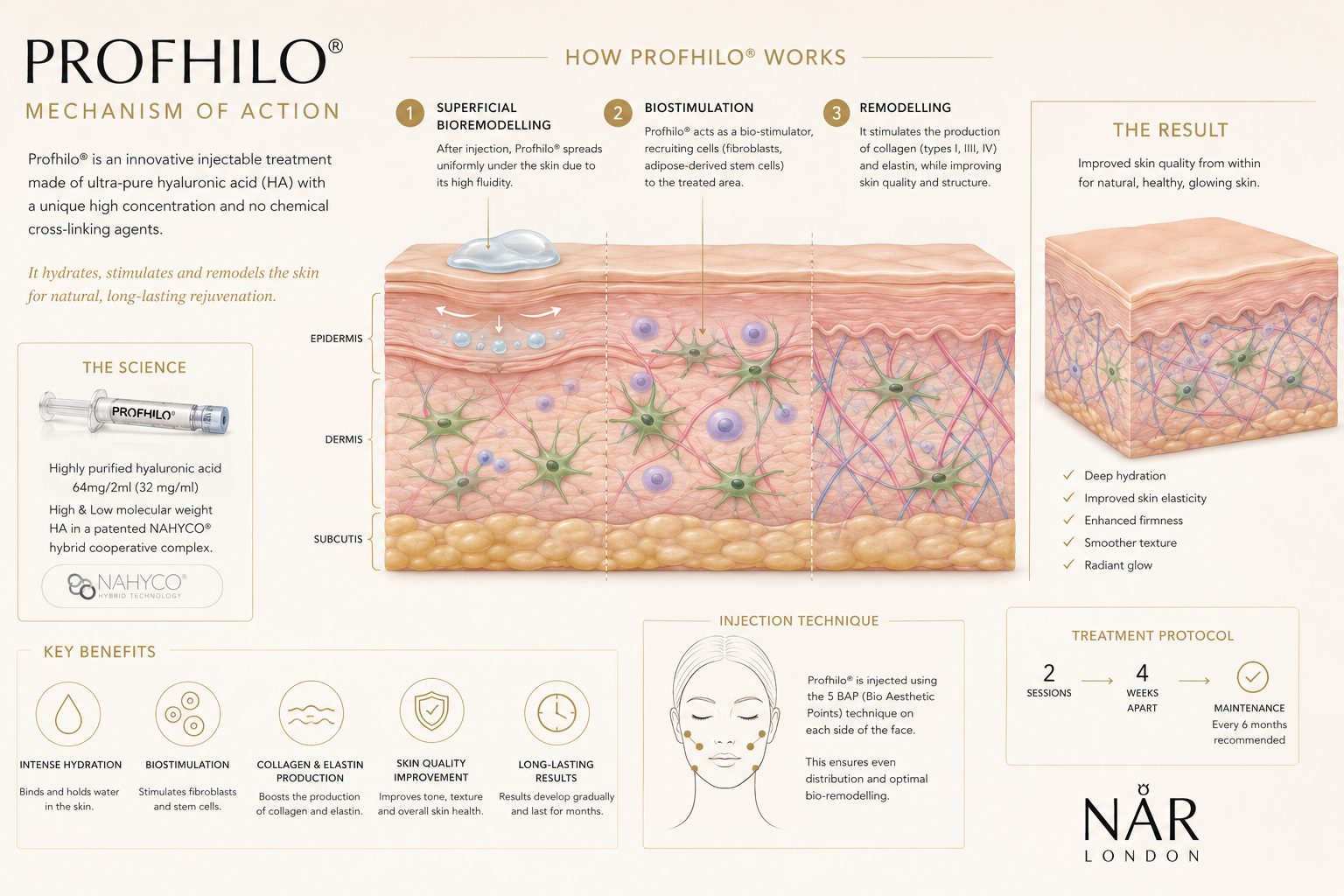Profhilo-Diagram Profhilo Diagram